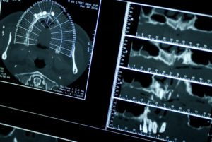 CT Dental Tomography