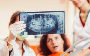 dentist showing patient an xray of wisdom teeth