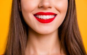A Beautiful Smile