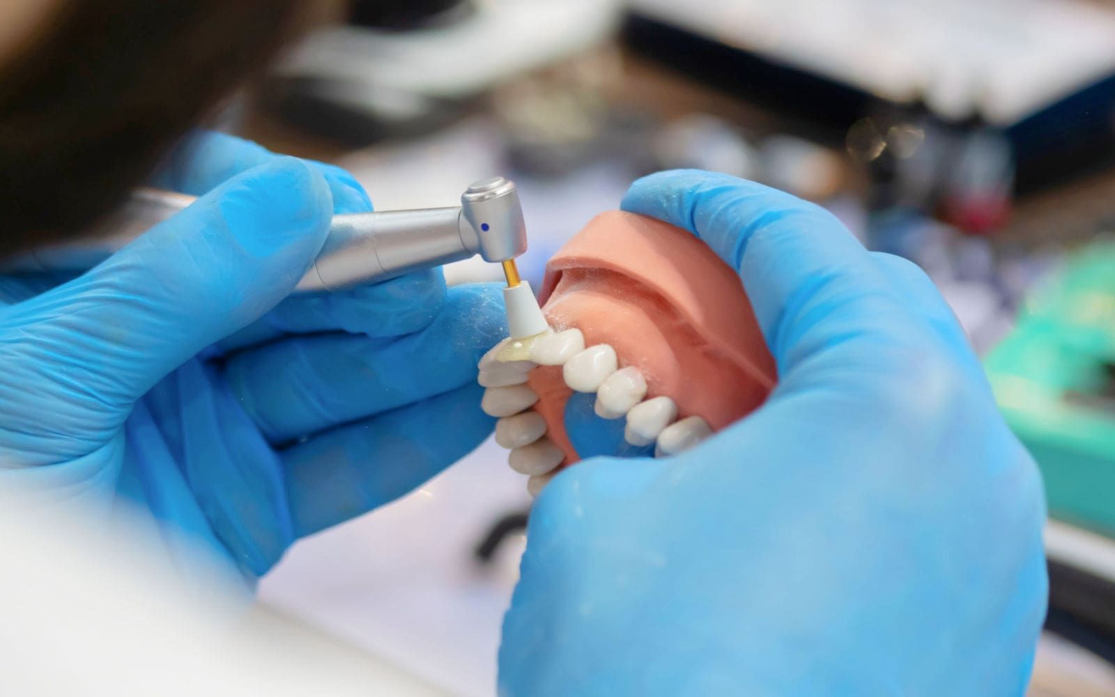 Direct vs. Indirect Restorations What’s the Difference? » Santa Ana